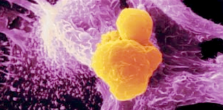 Cancer-Causing Enzyme Intentionally Being Added to All Vaccines