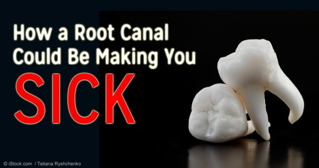 root-canal-make-you-sick-fb