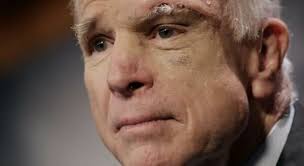 John McCain Split Eyebrow