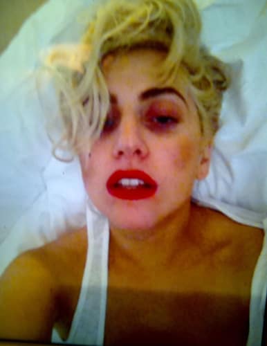 Lady Gaga Black Eye
