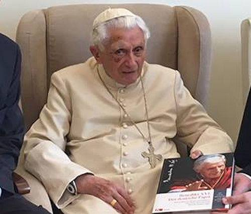 Pope Benedict XVI Black Eye
