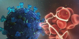 Discovery: Autopsies Prove that COVID-19 is a Disseminated Intravascular Coagulation (Pulmonary Thrombosis)