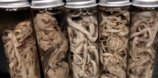 Embalmer Reveals 50% of Bodies Containing “White, Fibrous” Clots Since April/May 2021