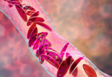 The world’s 1st CRISPR therapy has just been approved. Here’s everything you need to know