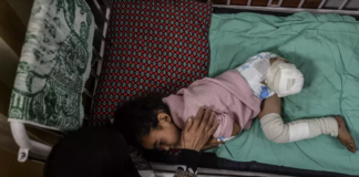 9,000 Gazan children have undergone amputations, many without anesthesia – Day 81