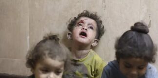 Most Moral Army In The World? Rise In Gaza Children With Headshot Wounds Stuns US Doctors