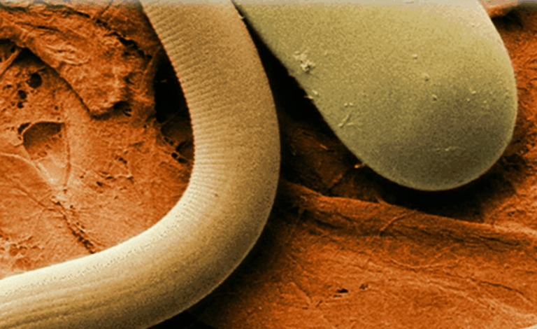 Herbs and a Protocol that Eliminates Parasites from the Body