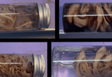 The Nefarious Science Behind the Clot Shots