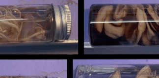 The Nefarious Science Behind the Clot Shots